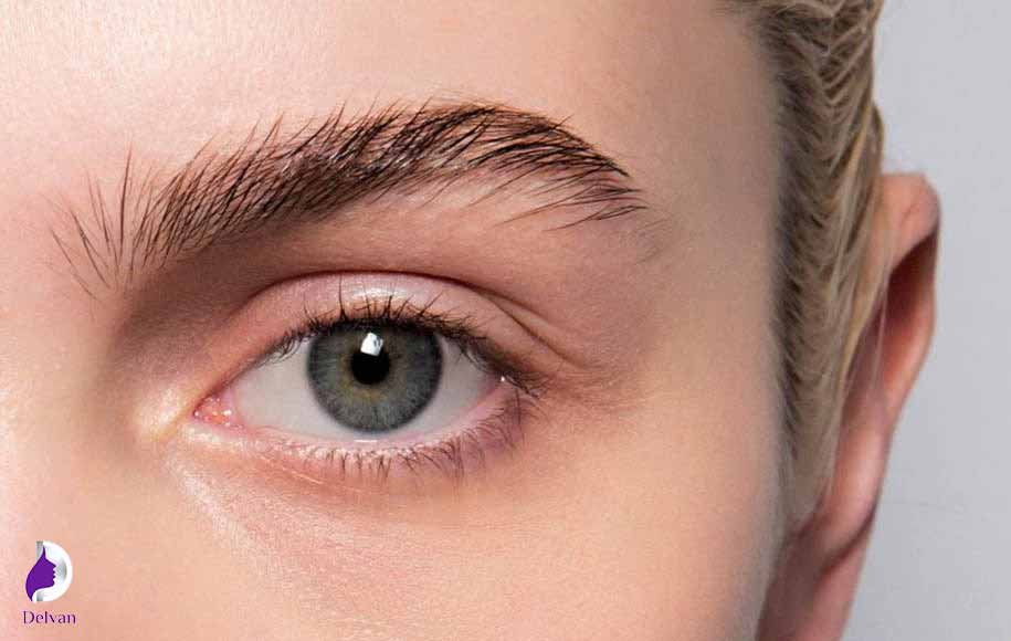 چگونه می‌توان از عفونت بعد از کاشت ابرو جلوگیری کرد؟