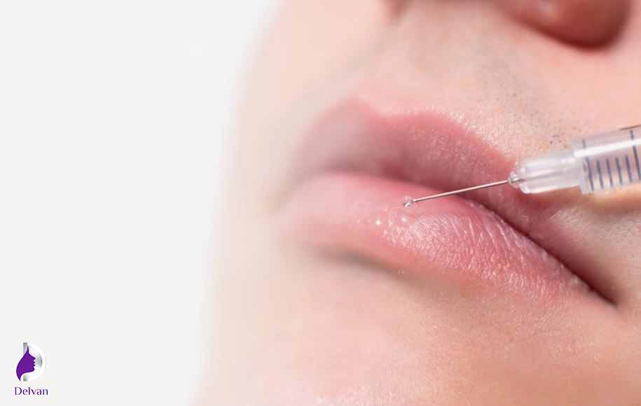 ژل لب چیست؟