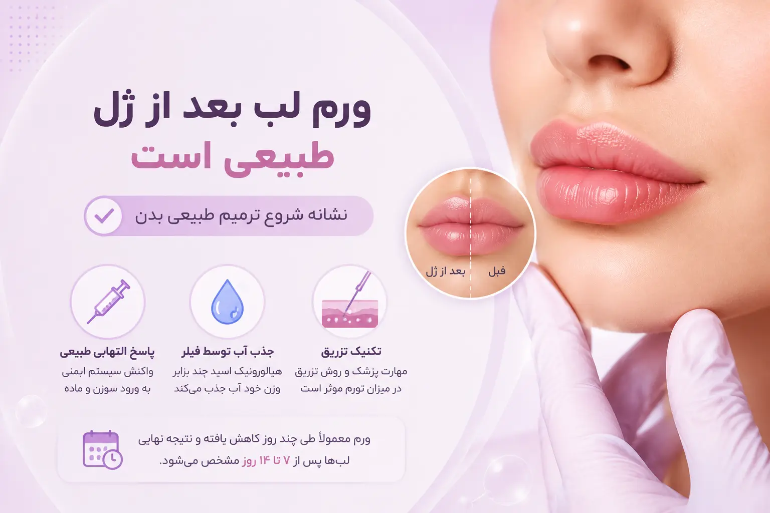 آیا ورم لب بعد از ژل طبیعی است؟