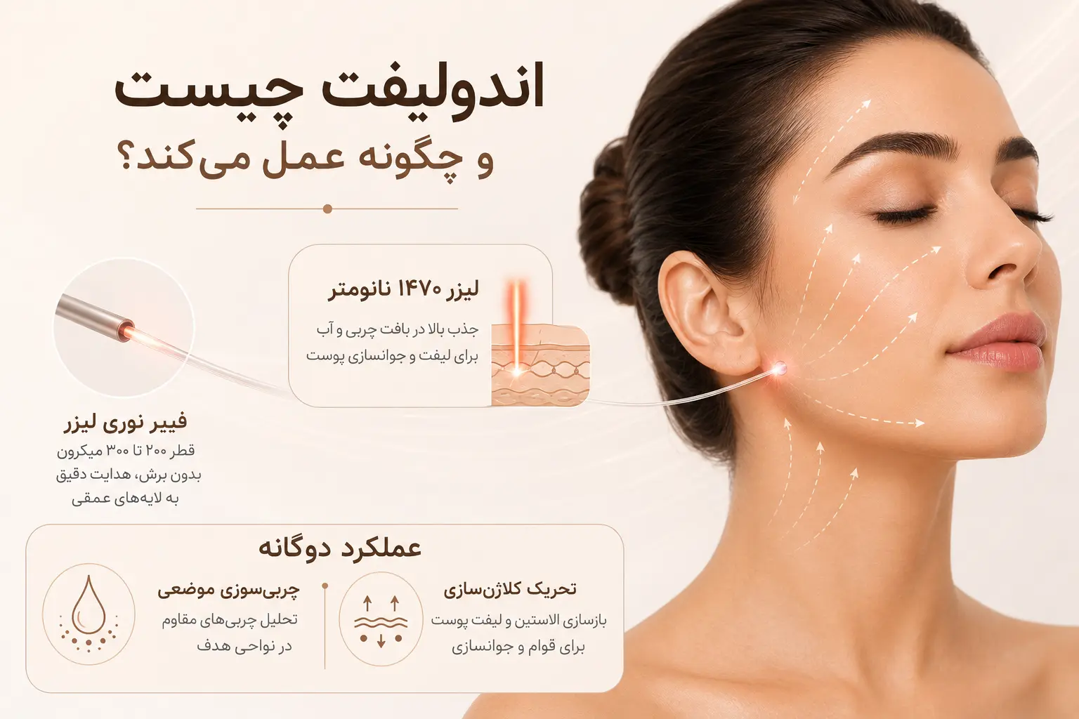 اندولیفت چیست و چگونه عمل می‌کند؟